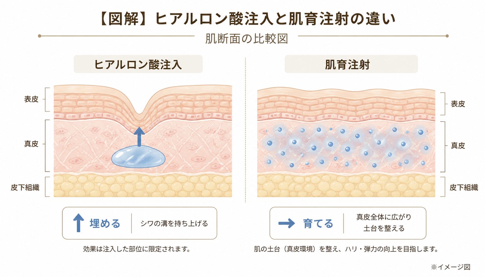 ヒアルロン酸注入と肌育注射の違い(肌断面の比較図)